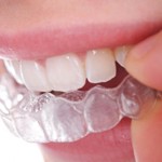 Nieng-rang-trong-suot-voi-hai-khay-nieng