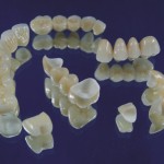 Phục hình răng sứ ở đâu tốt