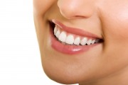 Bọc răng sứ venus giá bao nhiêu ?