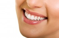 Bọc răng sứ venus giá bao nhiêu ?