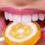 Niềng răng mặt lưỡi