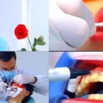 Các cách tẩy trắng răng tốt nhất