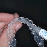 Nên tẩy trắng răng tại nha khoa hay tại nhà