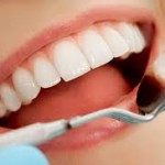 Quy trình làm răng sứ toàn sứ như thế nào ?