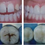 Thẩm mỹ hàm răng tại nha khoa