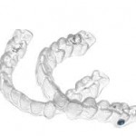 Niềng răng vô hình Invisalign