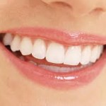 Niềng răng không phải nhổ là gì ?