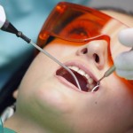 Tẩy trắng răng giá bao nhiêu ?