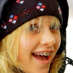 Niềng răng thẩm mỹ cho trẻ em