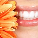 Ưu điểm của răng sứ E.Max