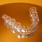 Niềng răng có bị đau không ?