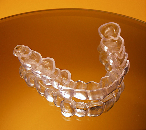 Niềng răng có bị đau không ?