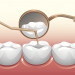 Điều trị tủy răng