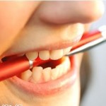 Cấy ghép Implant có đảm bảo an toàn ?