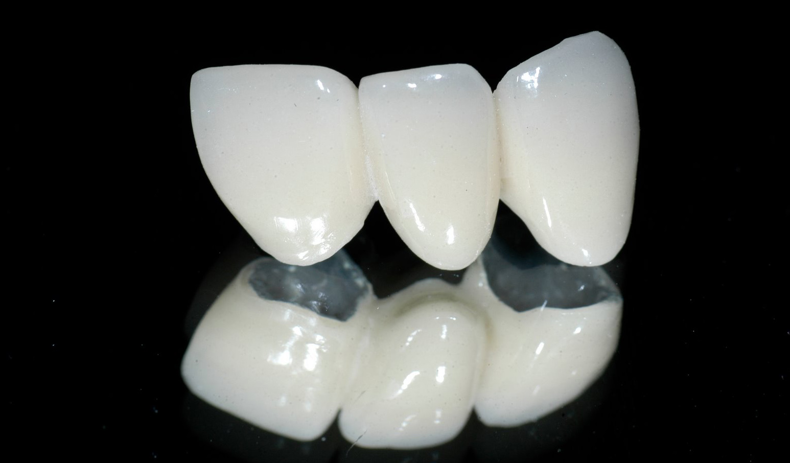 Ưu điểm của răng sứ Zirconia là gì ?