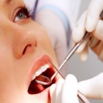 Niềng răng có phải nhổ răng