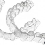 Niềng răng không mắc cài cho hàm răng mọc chen chúc