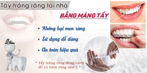 Tẩy trắng răng tại nhà